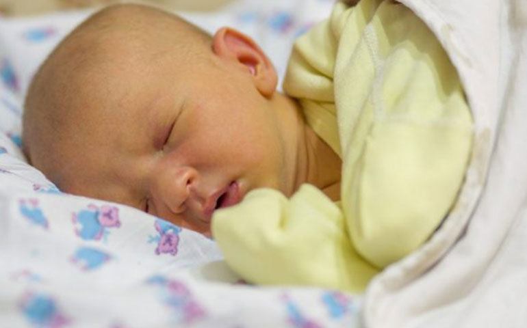 هیپربیلی روبینمی