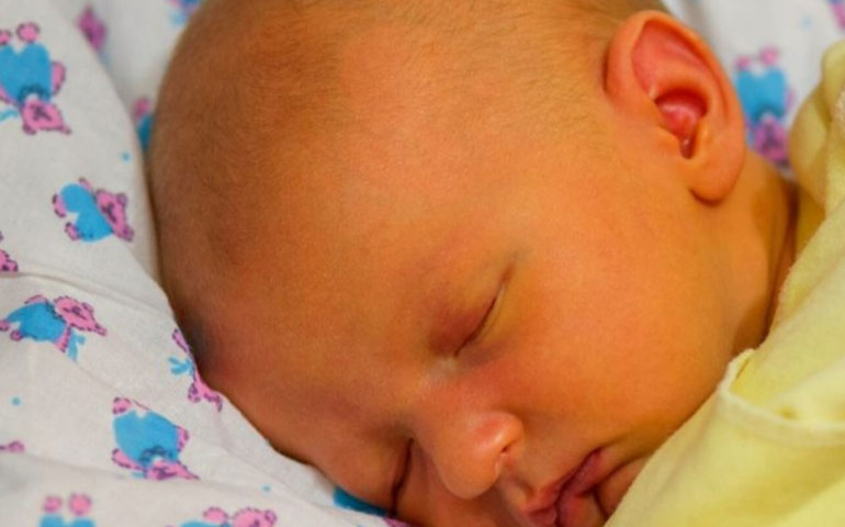 بیلی روبین چیست؟ 